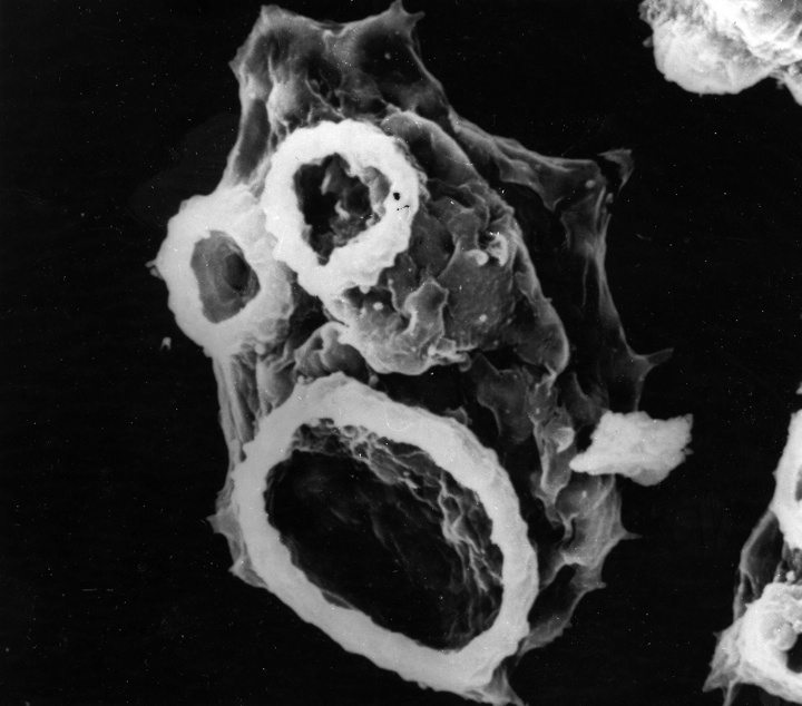 The sucker-like features of Naegleria fowleri